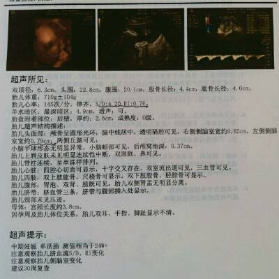 journal_insert_pic_699744296