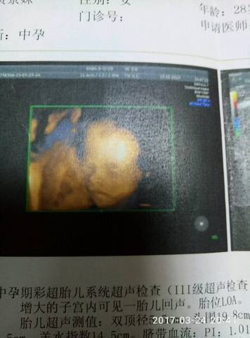 journal_insert_pic_701604426