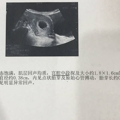 journal_insert_pic_701718181