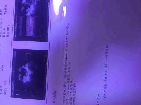 journal_insert_pic_703421598