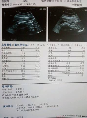 journal_insert_pic_703148092
