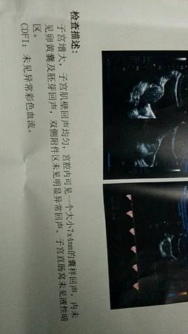 journal_insert_pic_703369678
