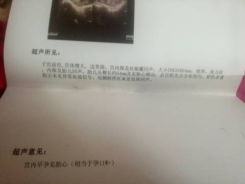 journal_insert_pic_703328742