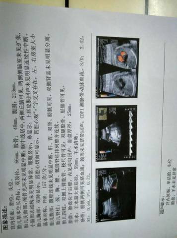journal_insert_pic_704309881