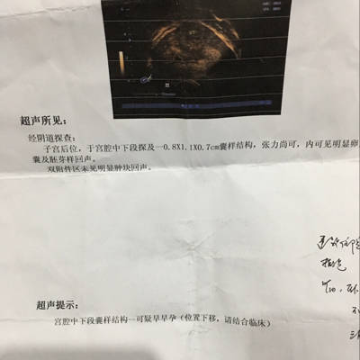 journal_insert_pic_704863461