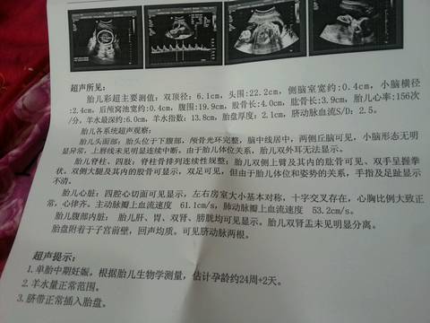 journal_insert_pic_706190156