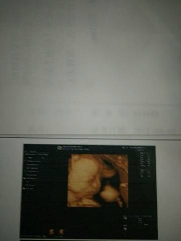 journal_insert_pic_708701569