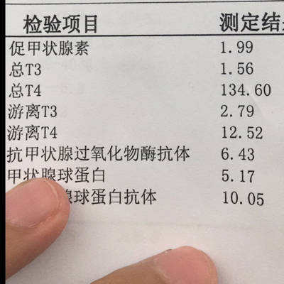 做甲状腺需要空腹吗?30号做出来是4.17.4月3号下午抽血做出来是1.99.