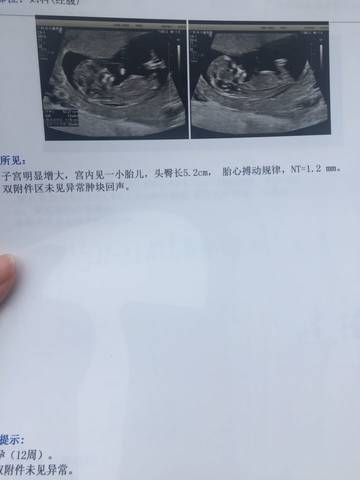 journal_insert_pic_708625145