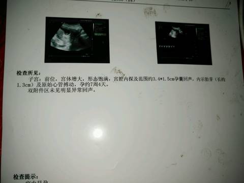 journal_insert_pic_711613622
