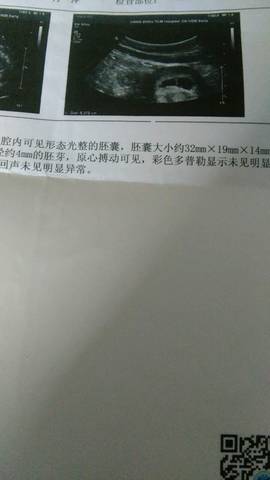 journal_insert_pic_711696209