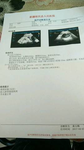 journal_insert_pic_712077831