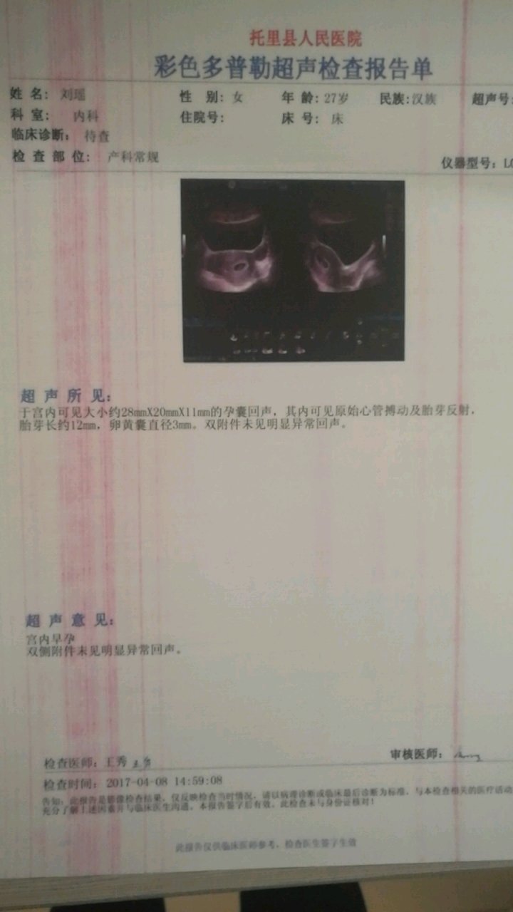 褐色分泌物宝妈进，接胎心胎芽！