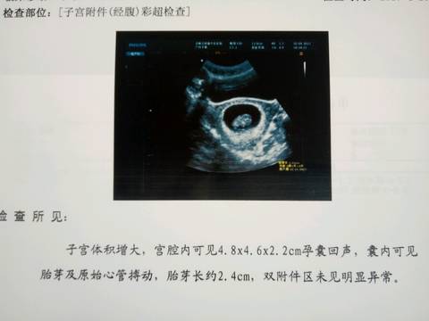 journal_insert_pic_714559763