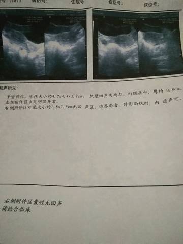 journal_insert_pic_717302940