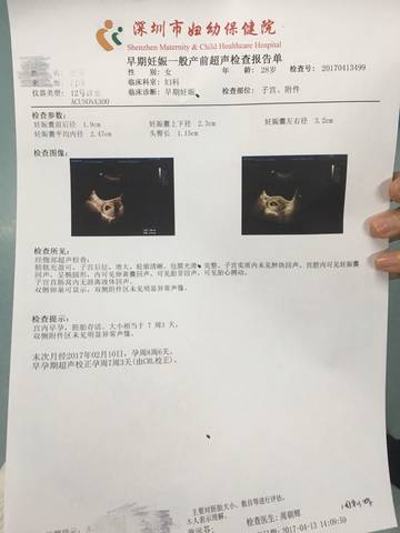 journal_insert_pic_717253282