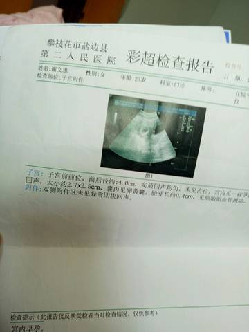 journal_insert_pic_717157511