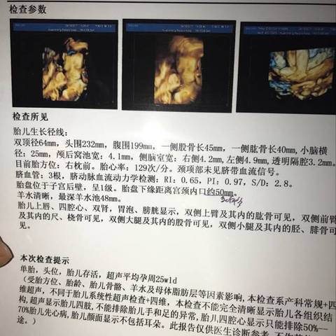 journal_insert_pic_717335321