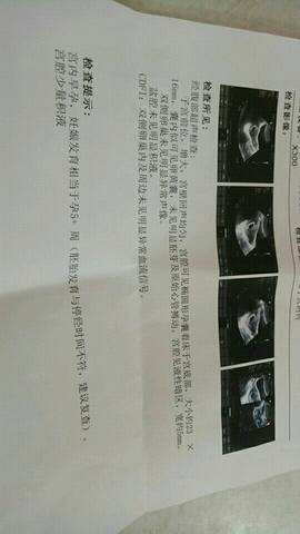 journal_insert_pic_717362271
