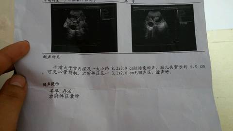 journal_insert_pic_719436215