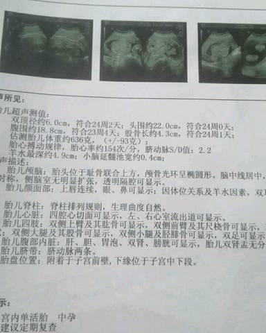 journal_insert_pic_720161107