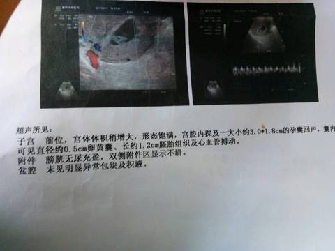 journal_insert_pic_720090474
