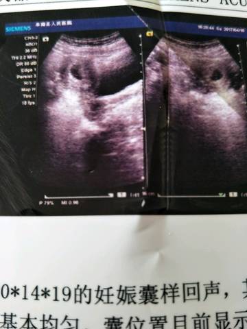 journal_insert_pic_721735661