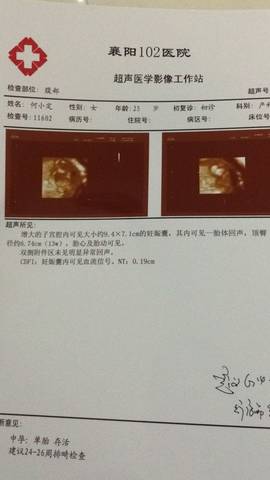 journal_insert_pic_722974612