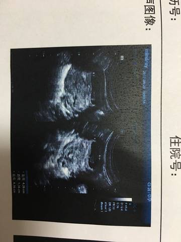 journal_insert_pic_722917627