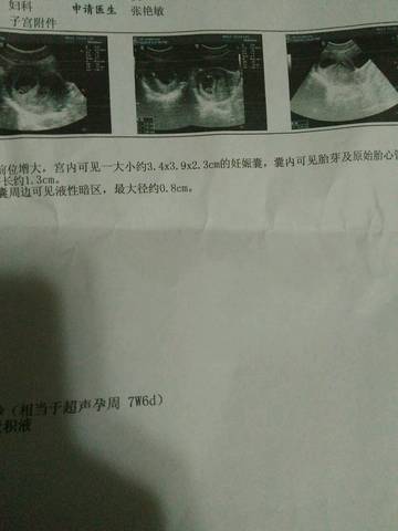 journal_insert_pic_723817333