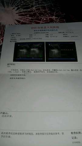 journal_insert_pic_727267467