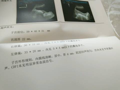 journal_insert_pic_728859542