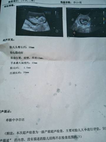 journal_insert_pic_731260169