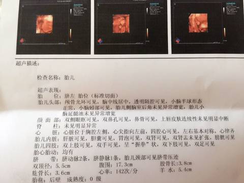 journal_insert_pic_730876605