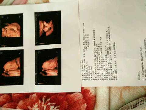 journal_insert_pic_733885880