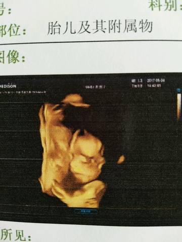 journal_insert_pic_733898533