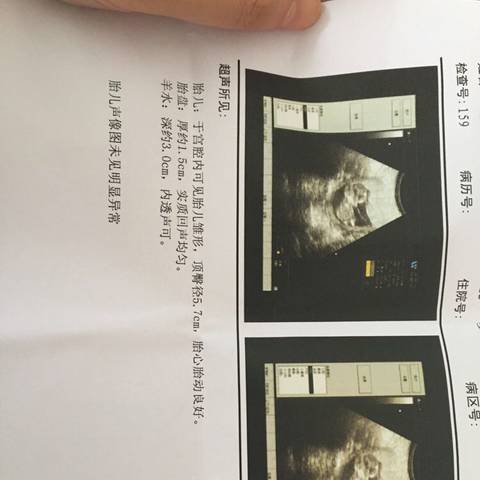 journal_insert_pic_734481749