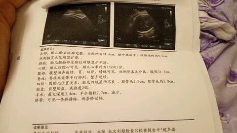 journal_insert_pic_736468603