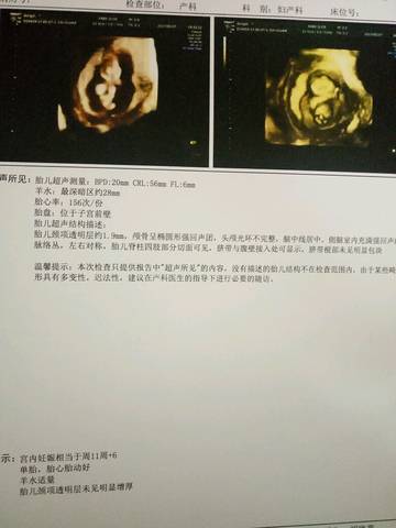 journal_insert_pic_737506024