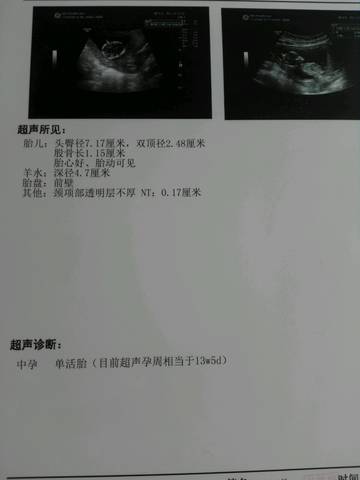 journal_insert_pic_737703068
