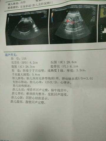 journal_insert_pic_738116098
