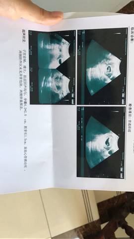journal_insert_pic_739220671