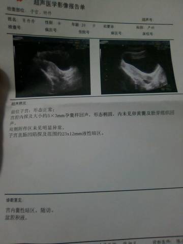 journal_insert_pic_739190884