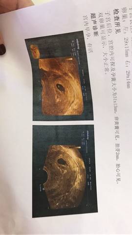 journal_insert_pic_739837938