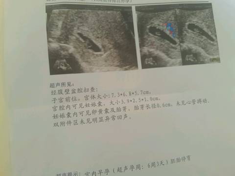 journal_insert_pic_741569646