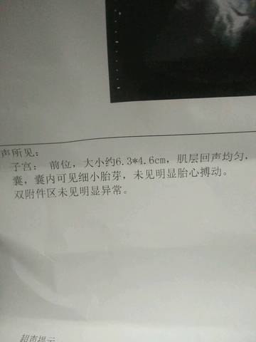 journal_insert_pic_741689148