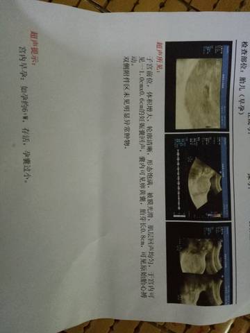 journal_insert_pic_742487643