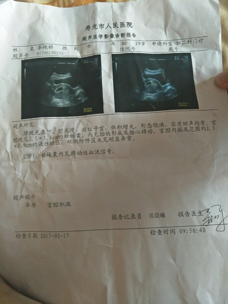 今天57天检查胎心胎囊正常