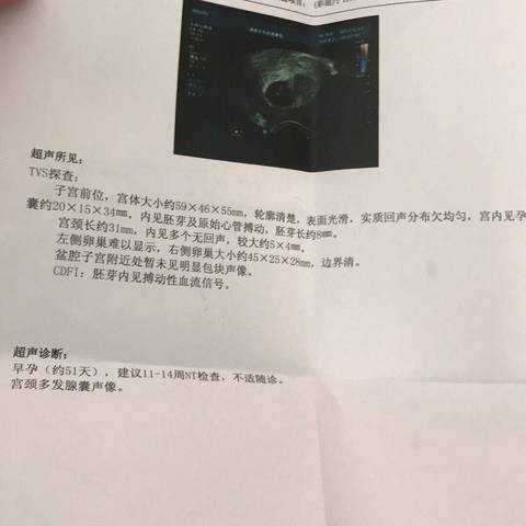 journal_insert_pic_743940795