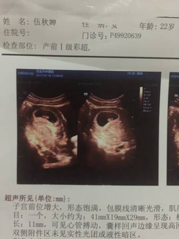 journal_insert_pic_744858765